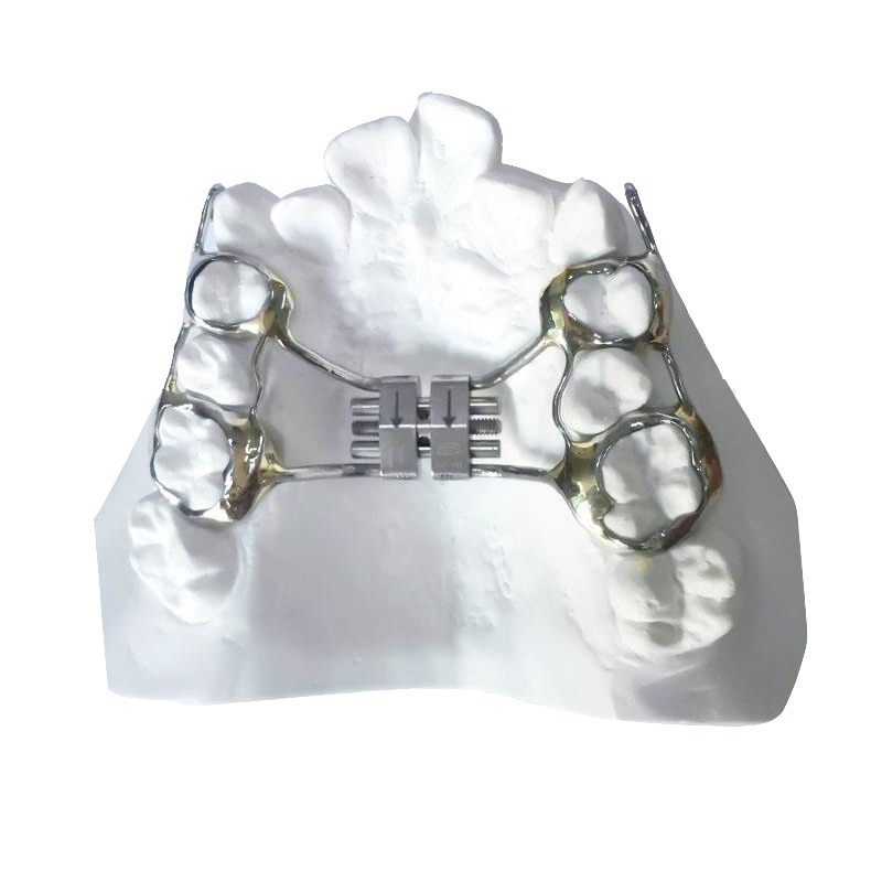 Ekspander Palatal Cepat