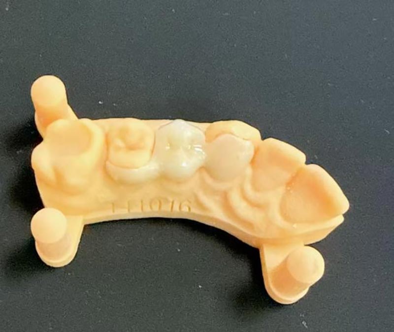 Apa yang Perlu Anda Ketahui Tentang Jembatan Maryland?