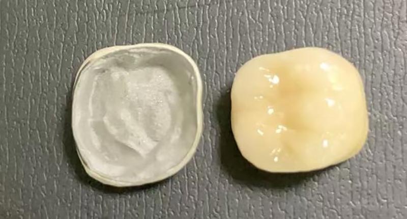 WM DENTAL LAB – Lab Gigi Terkemuka di Tiongkok