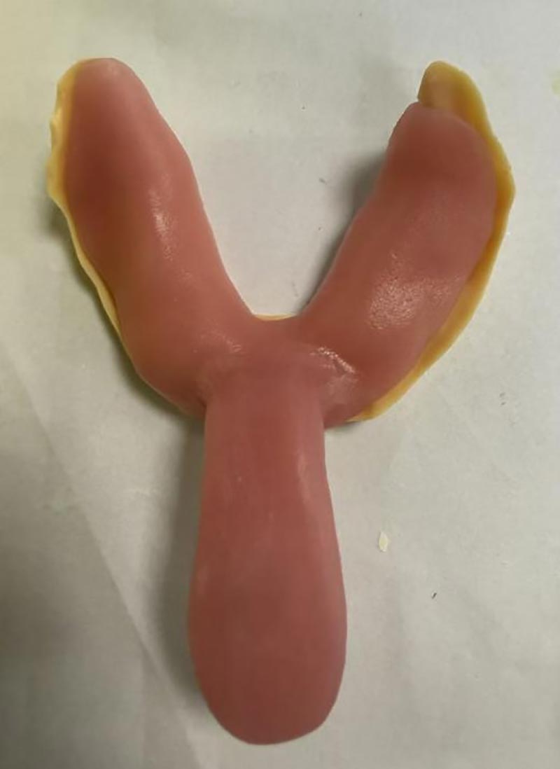 Hal yang Tidak Anda Ketahui Tentang Baki Gigi Khusus