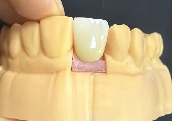 Celah Antar Gigi Bisa Diperbaiki—Gigi Lurus Adalah Yang Paling Menarik!