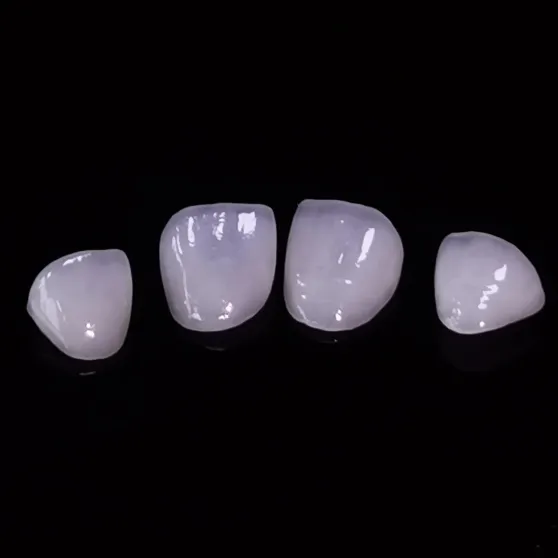 Bagaimana Seorang Profesional Akhirnya Tersenyum Percaya Diri di Setiap Pertemuan Setelah Mendapatkan Veneer Emax Estetika Tinggi?
