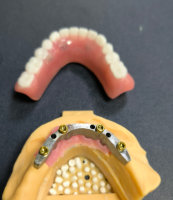 Pencari lokasi dan bar gigi